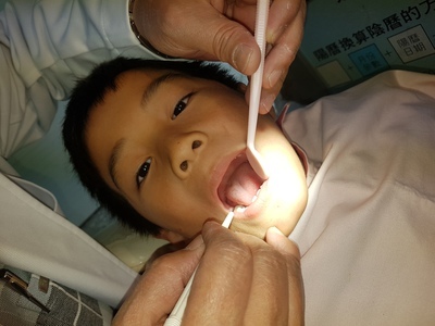 107.12.26-1.4年級學生牙齒缺點矯治填補圖片